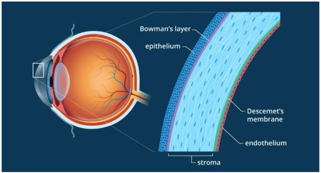 Endothelial Keratoplasty