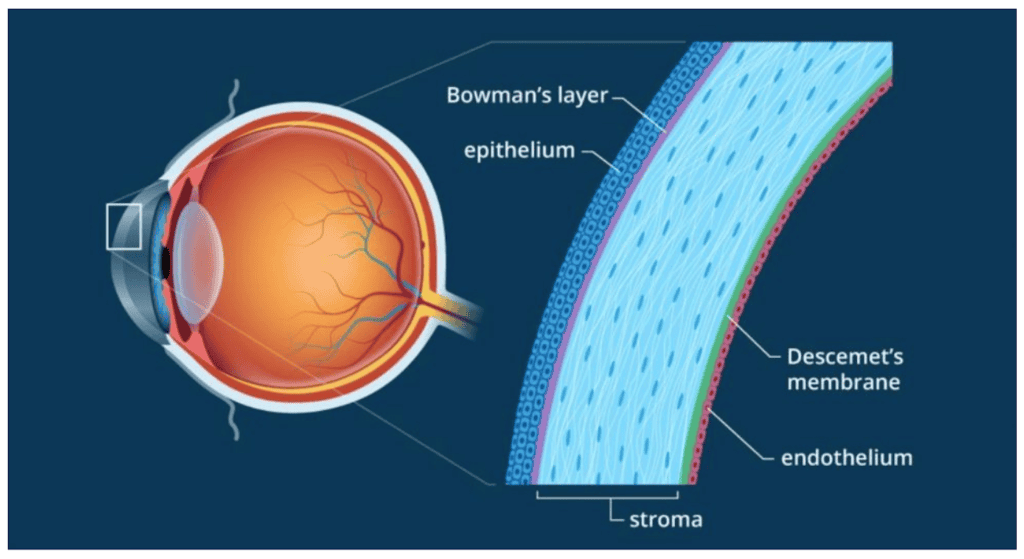 uchs-corneal-endothelial-dustrophy